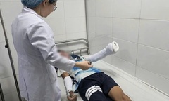 Nam sinh 14 tuổi bị thương nặng do tự chế pháo bằng lưu huỳnh theo video trên mạng
