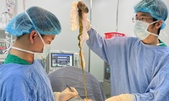 Kỳ lạ hội chứng ăn tóc: Búi tóc  "khổng lồ " chiếm hết dạ dày bé trai 6 tuổi