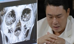 Nam ca sĩ đình đám ẩu đả kinh hoàng trong quán nhậu đến mức nhập viện