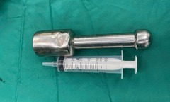Thiếu niên 15 tuổi cấp cứu vì  "dị vật khủng " mắc kẹt ở  "nơi nhạy cảm "