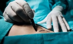 Chấn chỉnh việc thực hiện quy định về hiến, lấy, ghép mô,  bộ phận cơ thể người 