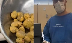 Sốc với hình ảnh bên trong bàng quang nam bệnh nhân uống 3 lít nước ngọt mỗi ngày