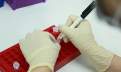 Góc khuất bi hài từ xét nghiệm ADN