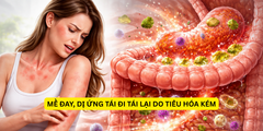 Mề đay, mẩn ngứa kéo dài có thể bắt nguồn từ đường ruột