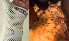 Người phụ nữ gãy xương cổ tay vì để mèo nặng 7,5kg gối đầu ngủ suốt đêm