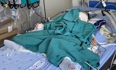 Nuốt nhầm hóa chất từ đồ học của anh trai, bé 2 tuổi nguy kịch