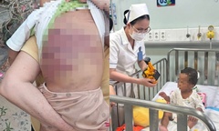 Bộ Y tế chỉ đạo  "nóng " liên quan đến vụ bé 2 tuổi bị bạo hành tại TP.HCM