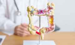 Người phụ nữ 26 tuổi tử vong sau những cơn đau bụng: Bác sĩ  "điểm mặt " 3 dấu hiệu bất thường hay bị coi nhẹ