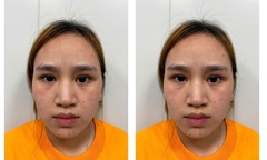  "Bóng hồng " sa ngã: Bắt  "nữ quái " lợi dụng ở ghép để trộm cắp tài sản