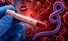Nguy cơ Ebola xâm nhập Việt Nam rất thấp, nhưng không thể chủ quan