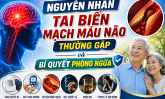 Nguyên nhân tai biến mạch máu não thường gặp và bí quyết phòng ngừa
