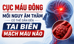 Cục máu đông: Mối nguy âm thầm có thể dẫn đến tai biến mạch máu não