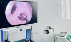 Đau tai đi khám, bệnh nhân hoảng hốt vì  "thứ đáng sợ " ẩn nấp bên trong