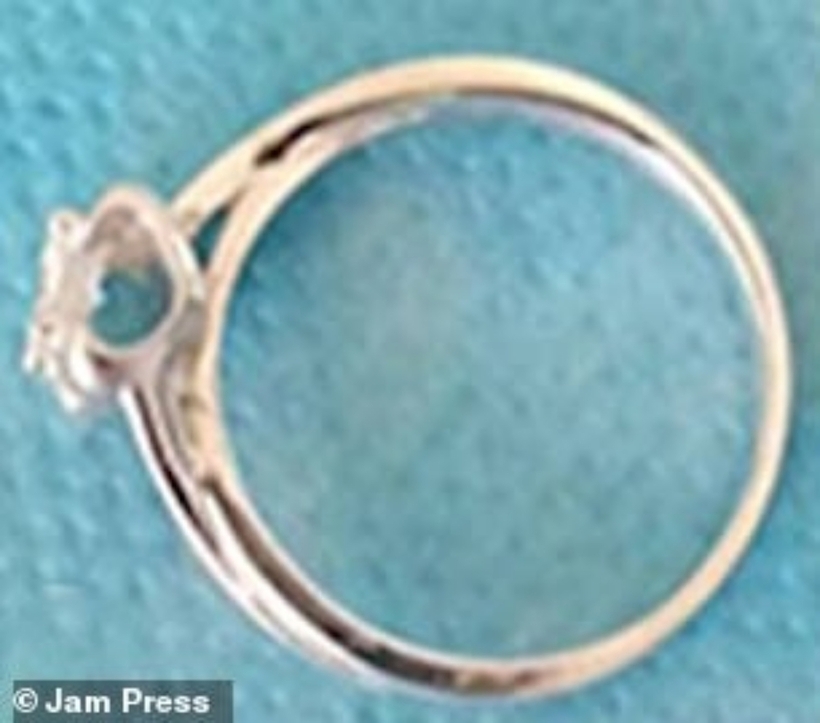 Chiếc nhẫn kim cương được các bác sĩ gắp ra ngoài. Ảnh: Daily Mail