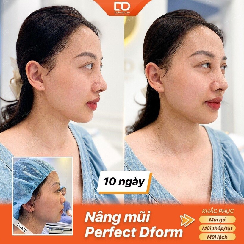 Bí quyết cho nhan sắc rạng ngời - Làm đẹp toàn diện cùng Thẩm mỹ DrD - 1