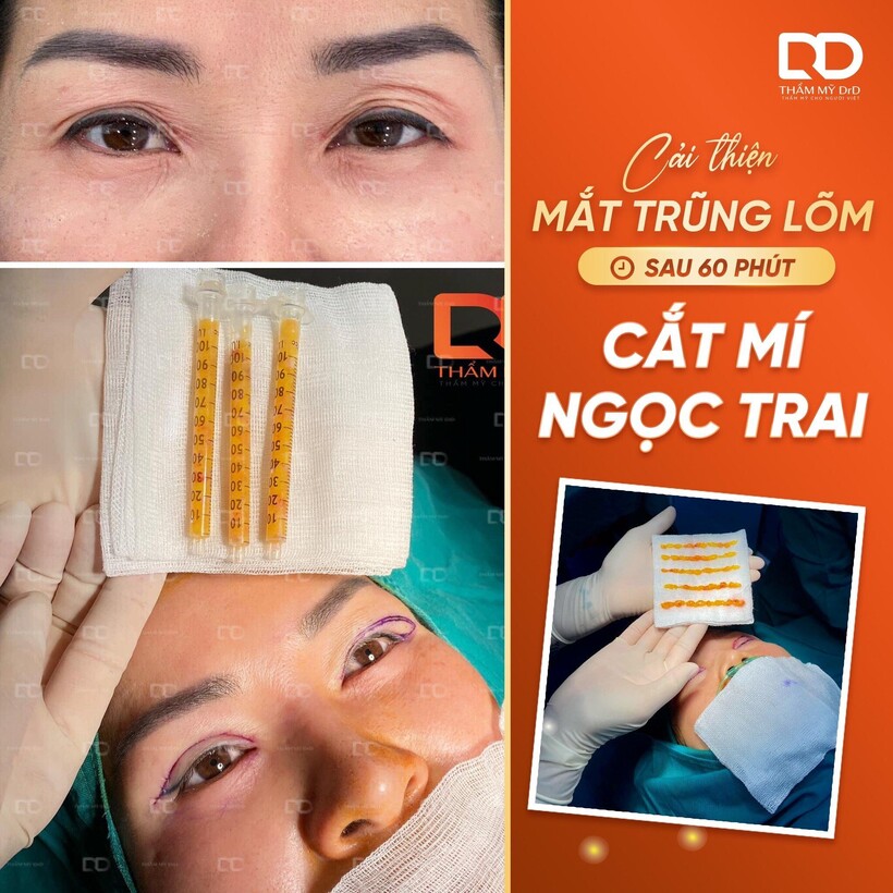 Bí quyết cho nhan sắc rạng ngời - Làm đẹp toàn diện cùng Thẩm mỹ DrD - 3