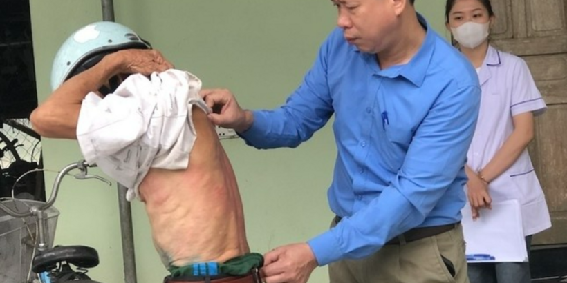 Chưa xác định được nguyên nhân gây ngứa. Ảnh: Tiền phong