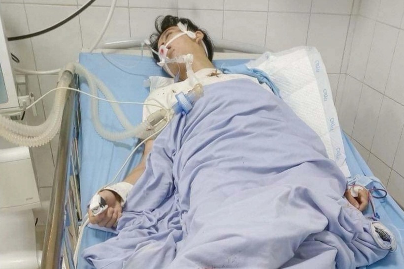 Hai học sinh lớp 11 bị nhóm thanh niên đánh nhầm. Ảnh: Dân Trí