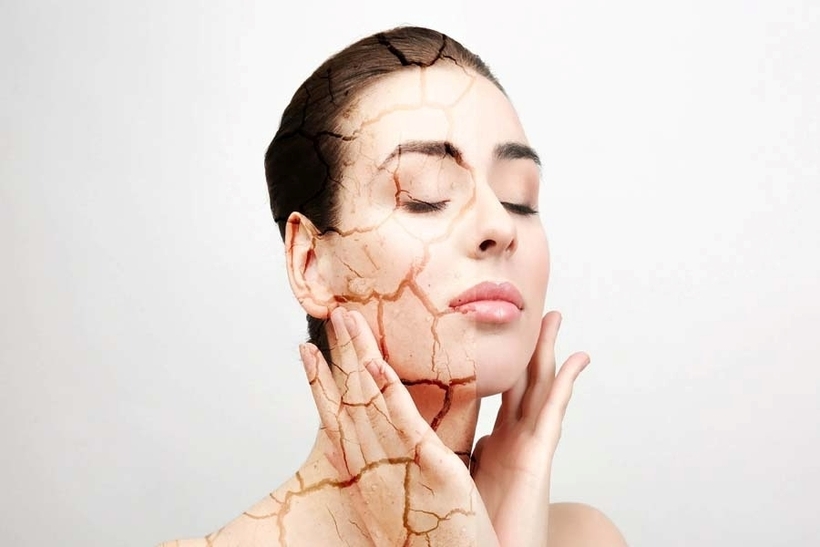 Sử dụng máy lạnh không đúng cách có thể khiến khô, ngứa da