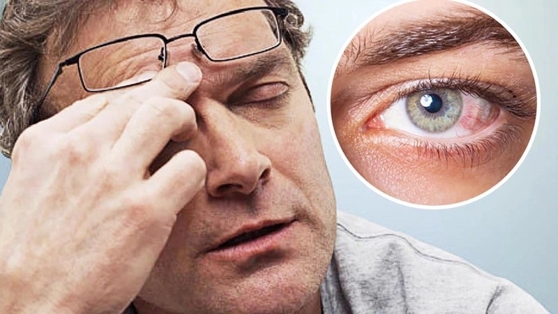 Ở trong môi trường máy lạnh quá lâu có thể là nguyên nhân gây khô mắt