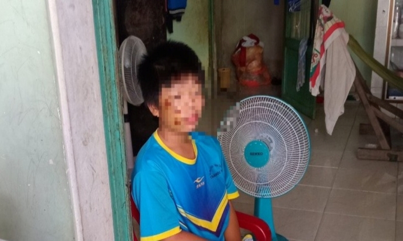 Nam sinh lớp 6 được cho là bị một bạn học cùng lớp có mâu thuẫn nên xô đẩy xe dẫn đến té xe bị trầy xước. Ảnh: Tuổi Trẻ
