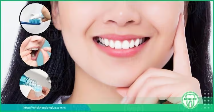 Răng hô nhẹ là thế nào? Có nên niềng răng hô nhẹ? - 2