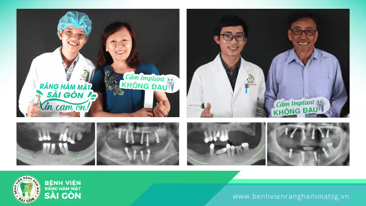 Trồng răng implant có đau không? Khi nào hết đau? - 1