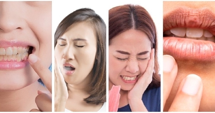 Nước lá me giúp cải thiện sức khỏe răng miệng