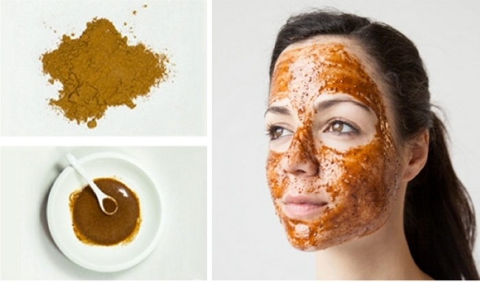 Quế có thể dùng để hỗ trợ trị mụn