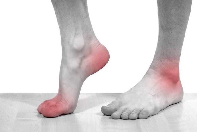 Theo thống kê, bệnh gout đang có xu hướng gia tăng và ngày càng trẻ hóa. Ảnh minh họa