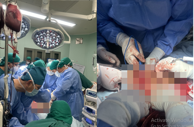 Kích hoạt quy trình báo động đỏ liên viện kịp thời cấp cứu cho nạn nhân. Ảnh: BVCC.