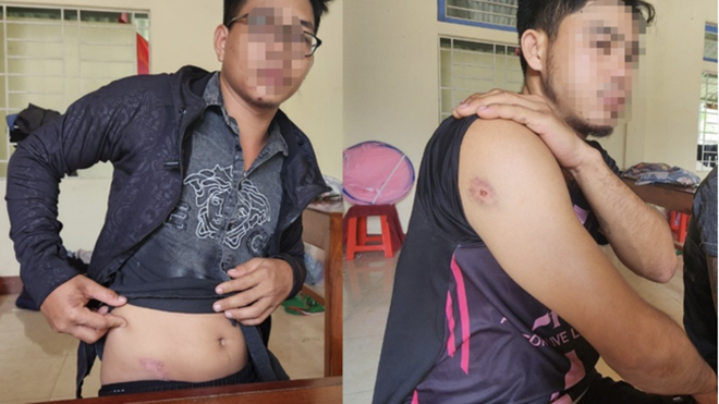 3 người lái máy gặt lúa bị nhóm thanh niên hành hung, gây thương tích. Ảnh: Báo Tiền phong.