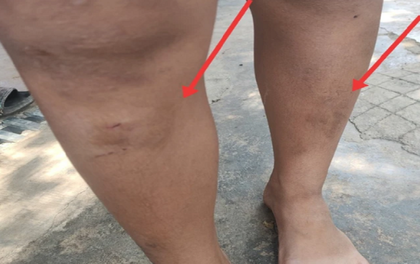 Một trong 5 cháu nhỏ bị 2 mẹ con bà T. đánh. Ảnh: Người lao động