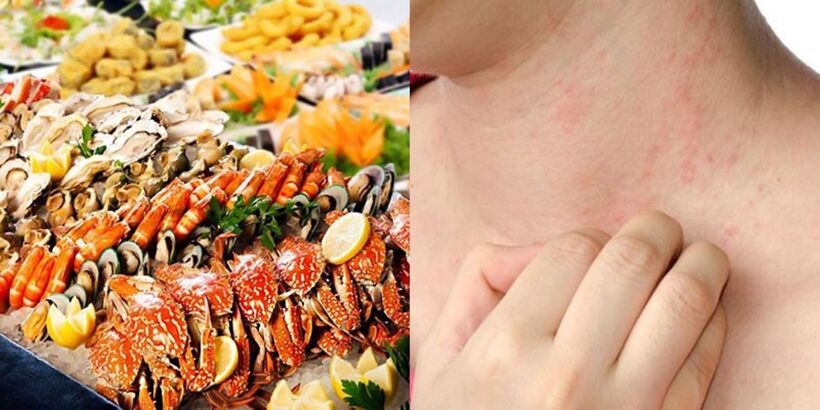 Những nguy cơ có thể phải đối mặt khi ăn hải sản.