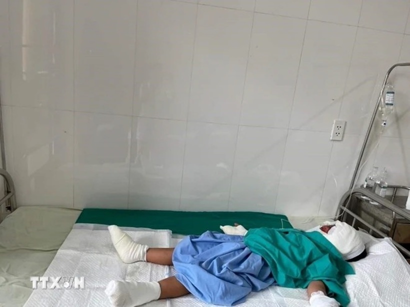 Bé trai 7 tuổi bị nặng hơn nên sẽ được chuyển lên Viện bỏng Quốc Gia. Ảnh: TTXVN.