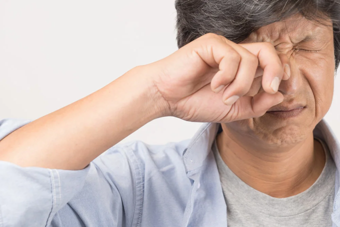 Dụi mắt quá thường xuyên hoặc quá mạnh có thể khiến vỡ mạch máu nhỏ, khiến mắt đỏ ngầu và có quầng thâm. Ảnh: Eye World.