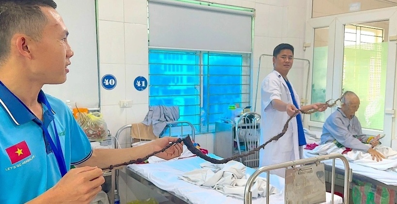 Chỏm tóc của cụ Sáo cần 2 người nắm hai đầu để đo. (Ảnh: Dân trí)