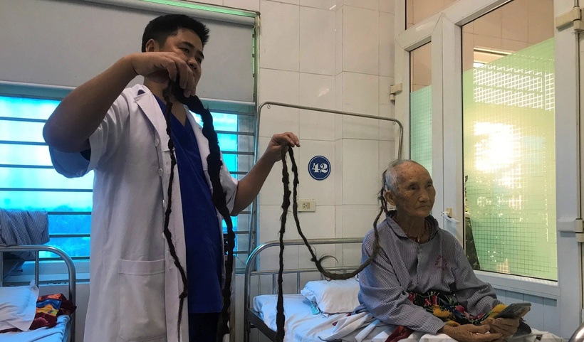 Bác sĩ vô cùng bất ngờ khi vô tình búi tóc của cụ bà bung ra. (Ảnh: Dân Việt)