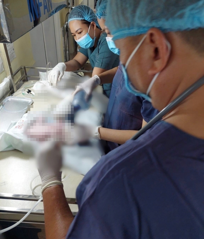 Y bác sĩ hồi sức em bé sau mổ. Ảnh: VOV