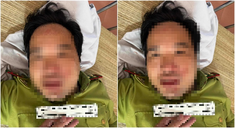 Ông Lê Duy Cường bị xe tải húc dẫn tới bị thương. (Ảnh: Giao thông)