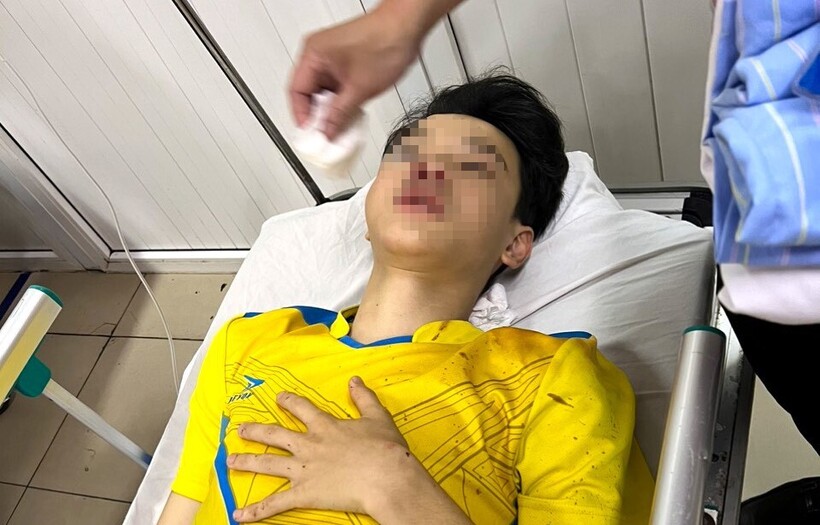 Nam sinh Trần Xuân Bảo Ph đang được điều trị tại BV đa khoa tỉnh Nghệ An. (Ảnh: Tiền phong)