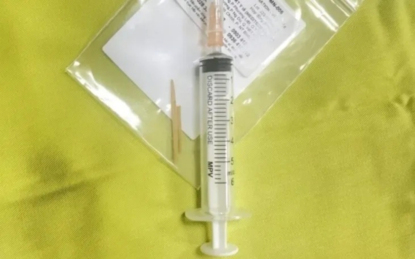 Dị vật là 1 cây tăm dài khoảng 6cm, đầu nhọn. Ảnh: VTV Times