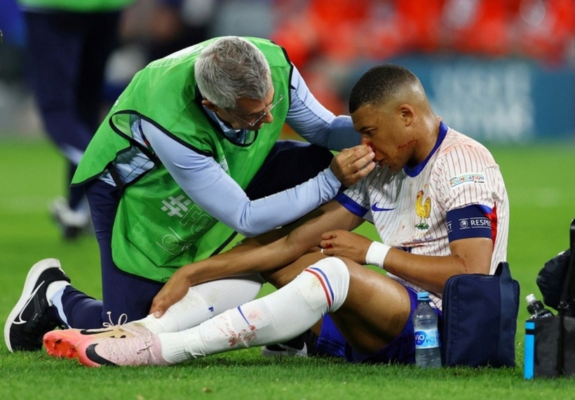 Mbappe bị chấn thương mũi ở những phút cuối hiệp 2. Ảnh: Reuters