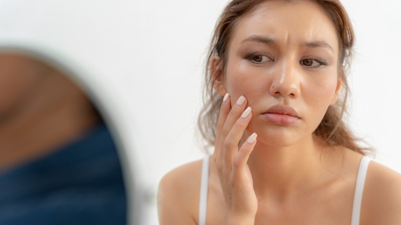 Nguyên nhân khiến da xỉn màu và cách khắc phục hiệu quả. Ảnh minh hoạ