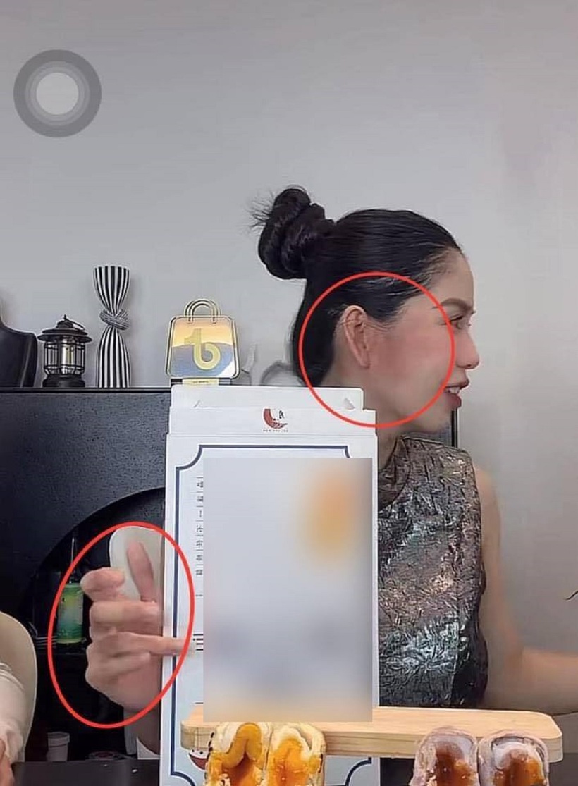 Cận cảnh những vết bầm tím trên cơ thể Hằng Du Mục - 1