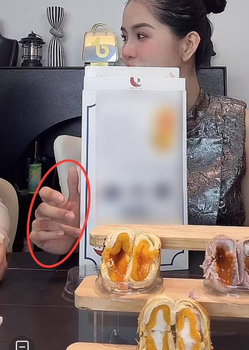 Má mặt, cổ và mu bàn tay của Hằng Du Mục có nhiều dấu vết lạ, nghi là vết bầm do bị tác động mạnh.