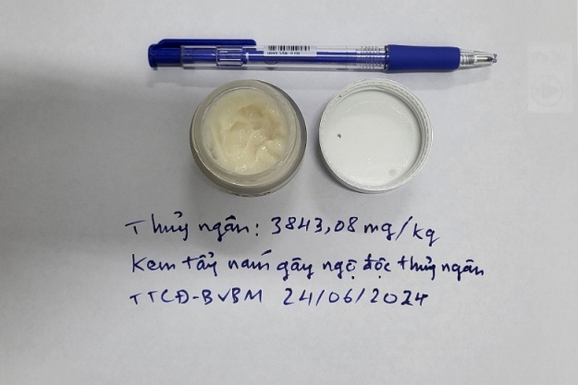Loại kem tẩy nám chứa thủy ngân mà người bệnh sử dụng trước khi nhập viện. Ảnh: An Ninh Thủ Đô