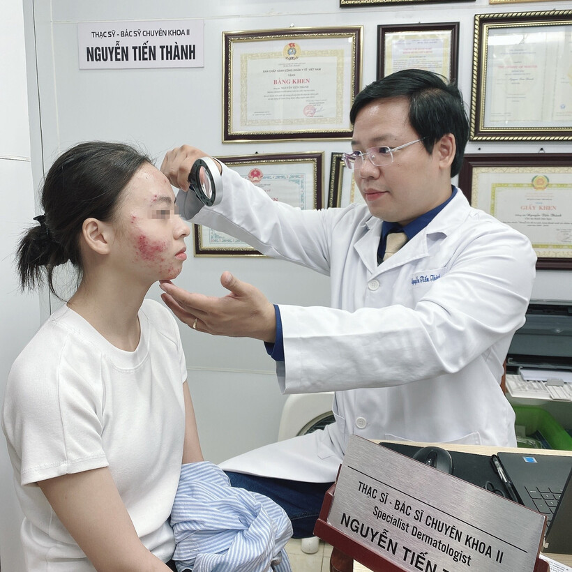 Sử dụng thuốc tránh thai trị mụn khiến mặt cô gái biến dạng
