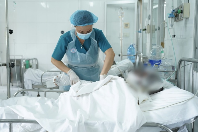 Một trong các bệnh nhân của vụ nổ ở Bình Dương. (Ảnh: BV)