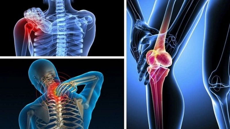 Các khớp sưng, tấy đỏ và có nguy cơ bị biến dạng do thoái hóa